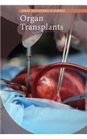 Organ Transplants