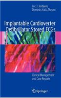 Implantable Cardioverter Defibrillator Stored ECGs