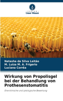 Wirkung von Propolisgel bei der Behandlung von Prothesenstomatitis