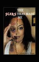 Scars That Made Me
