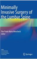 Minimally Invasive Surgery of the Lumbar Spine