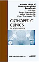 Current Status of Metal-On-Metal Hip Resurfacing, an Issue of Orthopedic Clinics