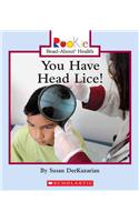 You Have Head Lice!