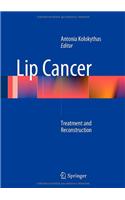 Lip Cancer