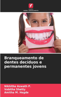 Branqueamento de dentes decíduos e permanentes jovens