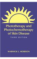 Phototherapy and Photochemotherapy for Skin Disease