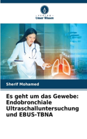 Es geht um das Gewebe