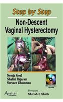 Step by Step Non-descent Vaginal Hysterectomy