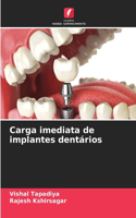 Carga imediata de implantes dentários
