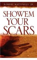 Show'em Your Scars