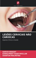 Lesões Cervicais Não Cariocas