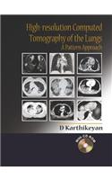 High-Resolution Computed Tomography of the Lungs: A Pattern Approach