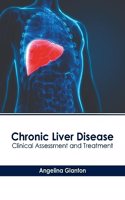 Chronic Liver Disease: Clinical Assessment and Treatment