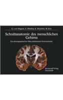 Schnittanatomie Des Menschlichen Gehirns