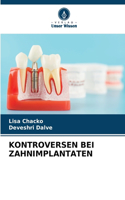 Kontroversen Bei Zahnimplantaten