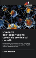 L'impatto dell'ipoperfusione cerebrale cronica sul cervello