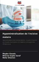 Hypominéralisation de l'incisive molaire