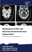 Применение КЛКТ при височно-нижнечелюстн