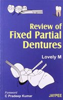 Review of Fixed Partial Dentures