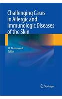 Challenging Cases in Allergic and Immunologic Diseases of the Skin