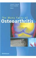 Many Faces of Osteoarthritis