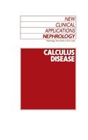 Calculus Disease