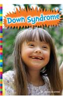 Down Syndrome: (Living With...)