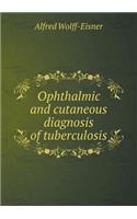 Ophthalmic and Cutaneous Diagnosis of Tuberculosis