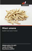 Miasi umana