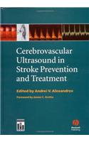 Cerebrovascular Ultrasound in Stroke Prevention and Treatment