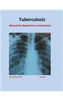 Tratamiento de Tuberculosis