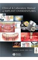 Clinical and Laboratory Manual of Implant Overdentures