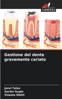 Gestione del dente gravemente cariato