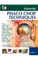Mastering Phaco Chop Techniques