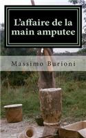 L'Affaire de la Main Amputee