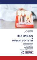 Peek Material in Implant Dentistry