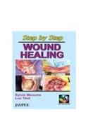 Step by Step Wound Healing