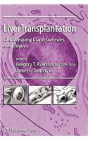 Liver Transplantation