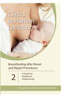 Breastfeeding after Breast and Nipple Procedures