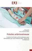 Fistules artérioveineuse