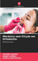 Mecânica sem fricção em Ortodontia.