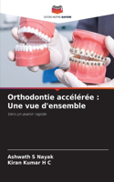 Orthodontie accélérée