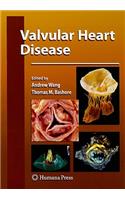 Valvular Heart Disease