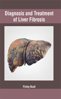 Diagnosis and Treatment of Liver Fibrosis