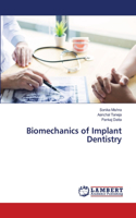 Biomechanics of Implant Dentistry