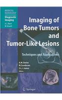 Imaging of Bone Tumors and Tumor-Like Lesions