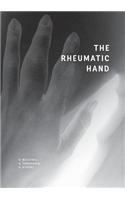 Rheumatic Hand