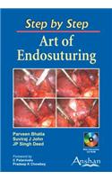Art of Endosuturing: Step by Step