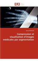 Compression Et Visualisation D Images Médicales Par Segmentation
