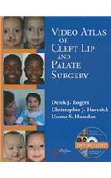 Video Atlas of Cleft Lip and  Palate Surgery